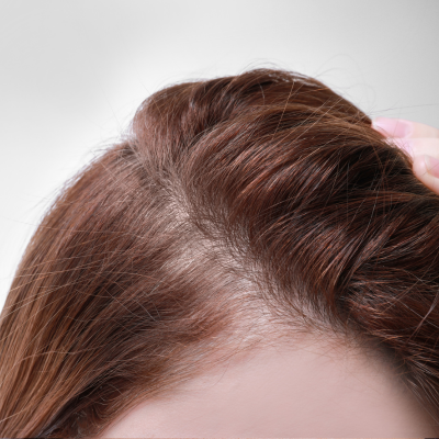 FPHL SOLUTIONS THE HAIR LOSS CLINIC UK