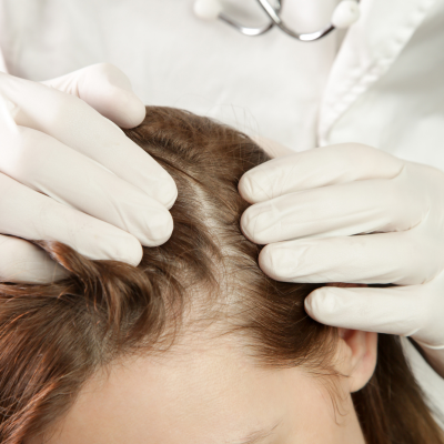 ONLINE HAIR LOSS SERUMS FOR WOMEN IN THE UK