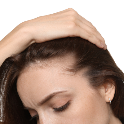 ONLINE HAIR LOSS TREATMENTS FOR WOMEN UK