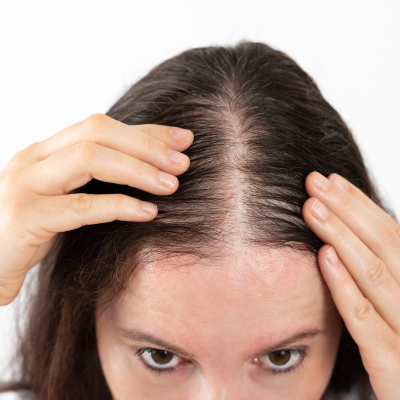 online hair loss serums at The Hair Loss Clinic Uk