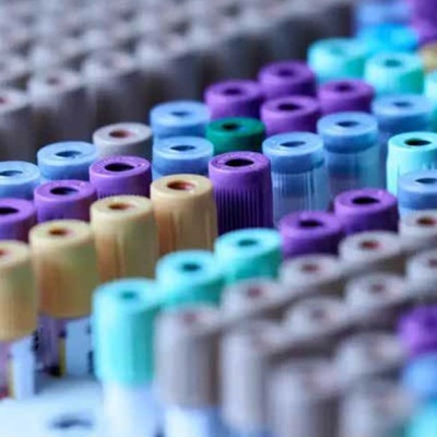 genetic testing for hair loss at The Hair Loss Clinic Uk